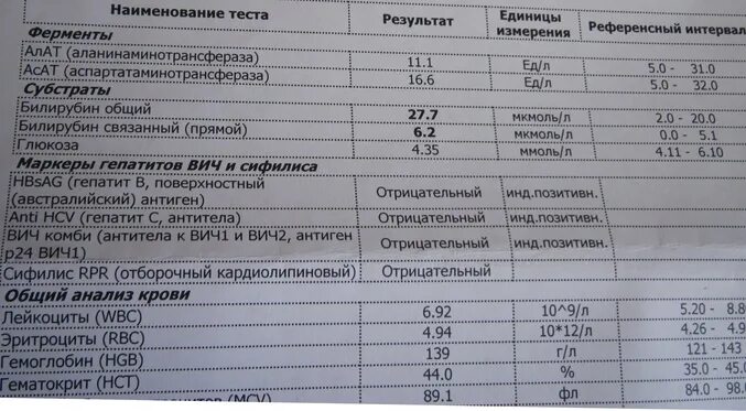 Что значит результат 7. Результат анализа на сифилис. Анализ крови на сифилис результат. Исследование крови на сифилис анализ. Анализ крови на ВИЧ И сифилис.