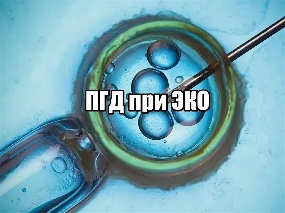 Что такое пгт при эко. Пгд. пгд эмбриона. пгд при эко. преимплантационная генетическая диагностика.