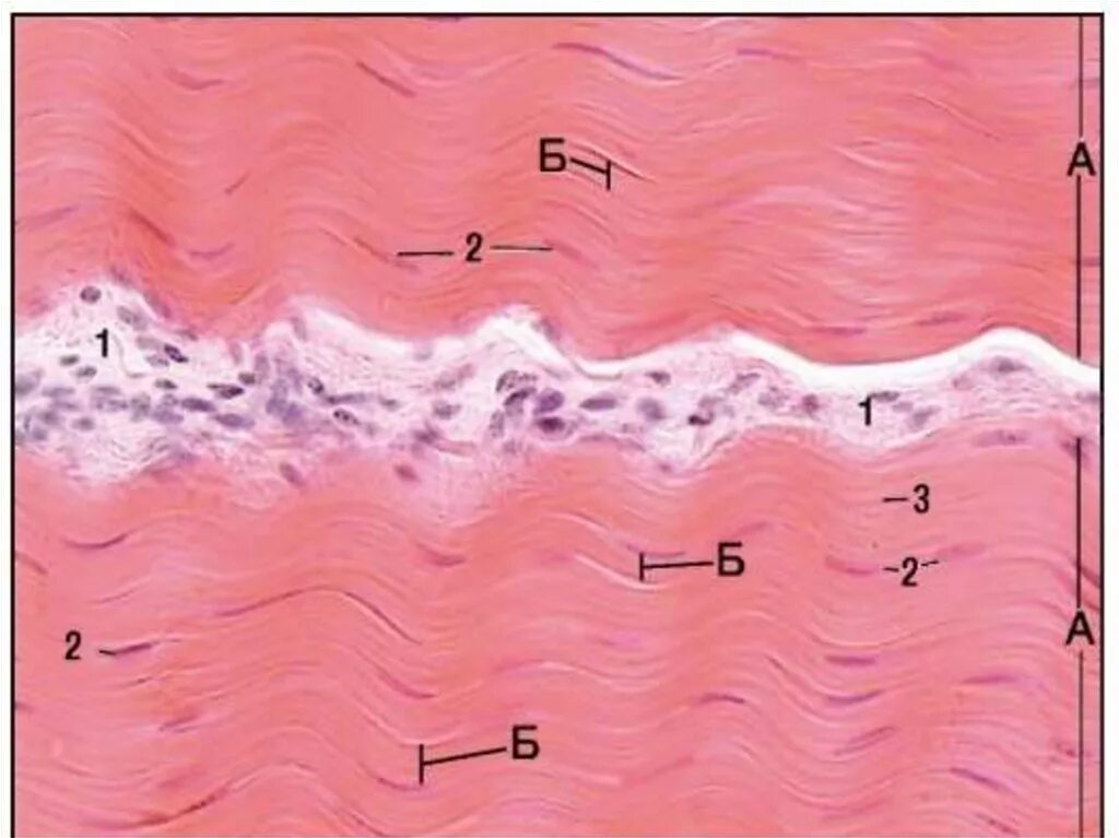 Плотная оформленная ткань. Плотная соединительная ткань гистология. Плотная оформленная соединительная ткань сухожилия. Плотная оформленная соединительная ткань препарат. Плотная волокнистая соединительная ткань гистология.