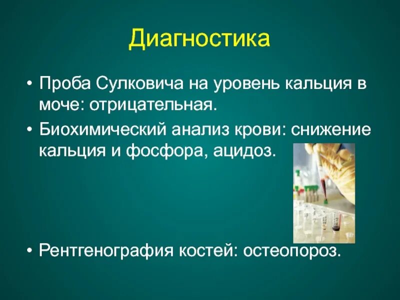 Моча на кальций и фосфор
