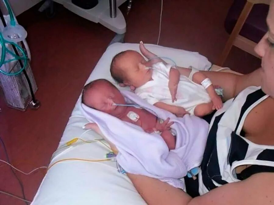 Проблемы двойни. Двойняшки мальчики беременность. Уход за двойняшками. Дети двойняшки. Родились двойняшки.