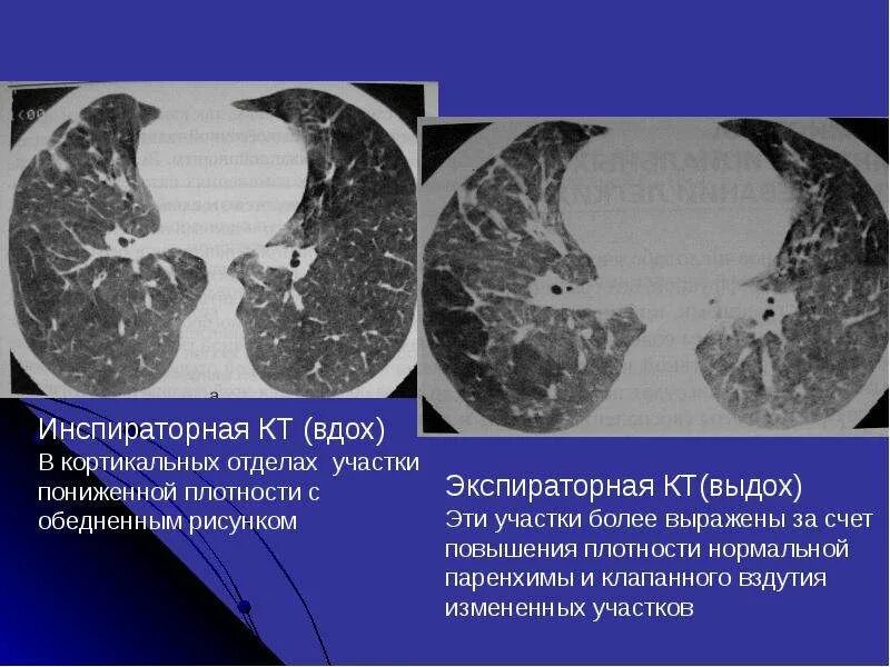 Участок уплотнения по типу матового стекла
