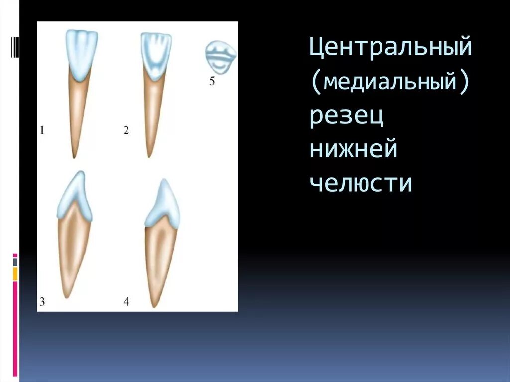 Зуб боковой резец. Медиал резец нижный челюсти. Молочный медиальный резец верхней челюсти. Медиальный верхний резец правый. Правый медиальный резец нижней челюсти.