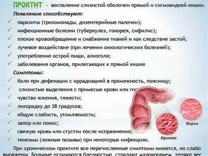 Сигмоидит симптомы лечение болит живот слева