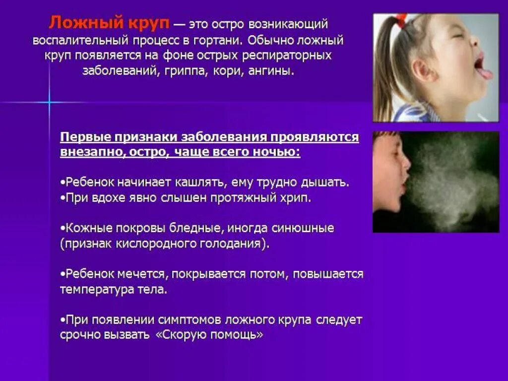 Помощь при ларингите