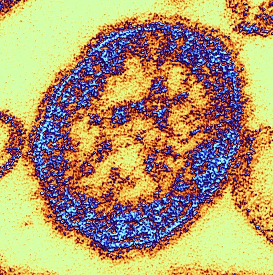 Вирус возбудителя кори. Measles Morbillivirus. Вирус кори РНК.
