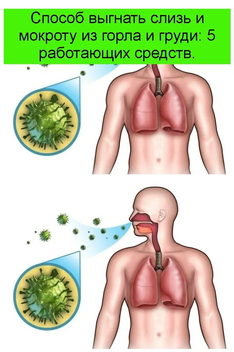 Зеленая мокрота что делать
