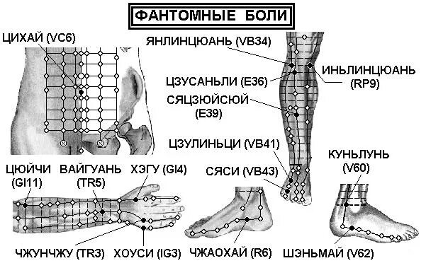 Фантомные боли лечение. Фантомные боли. ФО нтомные Бодт. Фантомные боли патогенез. Механизм развития фантомных болей.