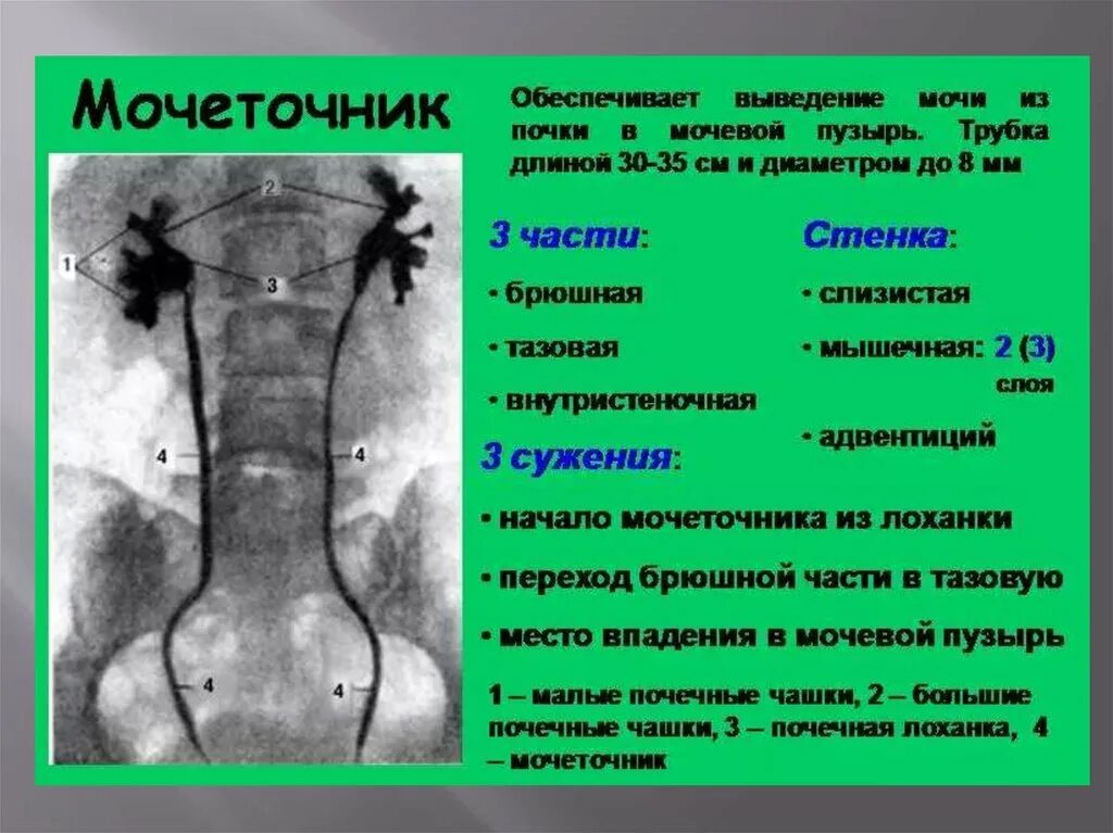 Юкставезикальный отдел мочеточника схема