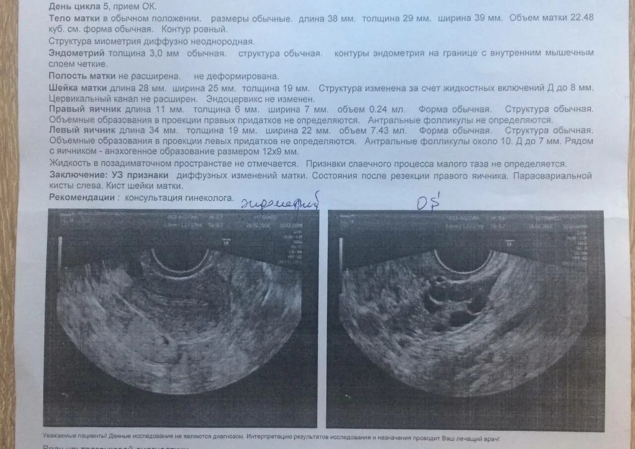 Толщина эндометрии для зачатия. Матки эндометрий 12мм. Эндометрий на 5 день цикла по УЗИ. Эндометрий на УЗИ по дням цикла. Эндометрий матки норма мм.