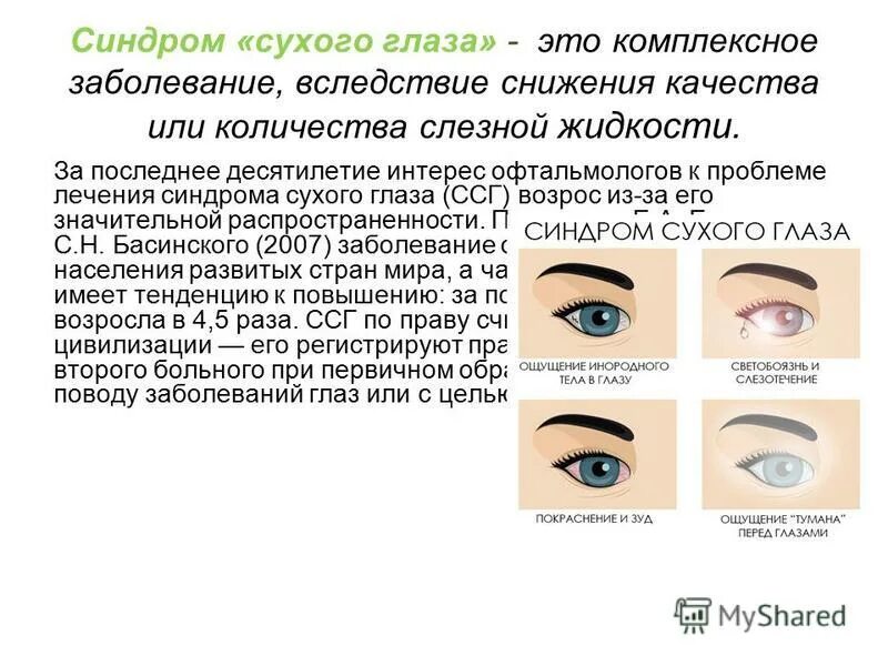 синдром сухого глаза у ребенка. причины возникновения синдрома сухого глаза. синдром сухого глаза у ребенка. капает в глаза. лимбальный кератоконъюнктивит.
