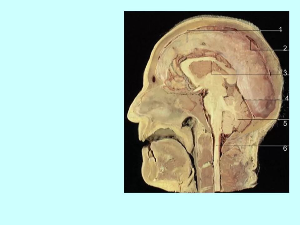 1 масса головного мозга. Мозг в черепной коробке анатомия. Головной мозг в полости черепа. Расположение головного мозга в черепе. Продолговатый мозг в черепе.