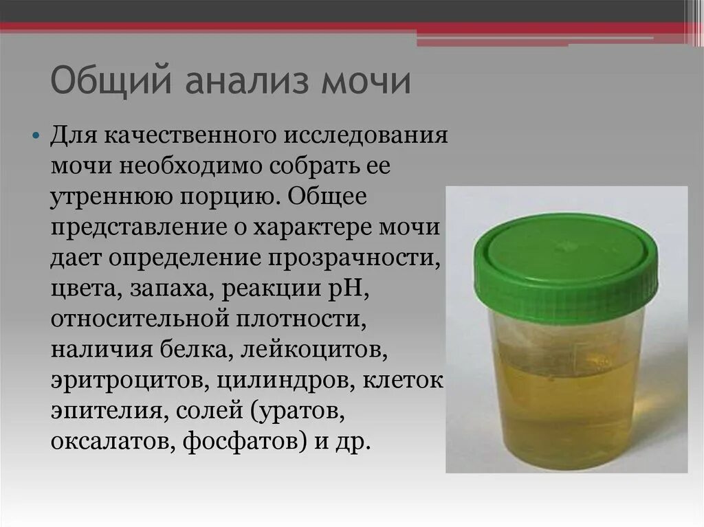 Анализ мочи. Кол во мочи для общего анализа. Меча для анвлиз. Необходимый объем мочи для анализа. Можно мочу ставить в холодильник