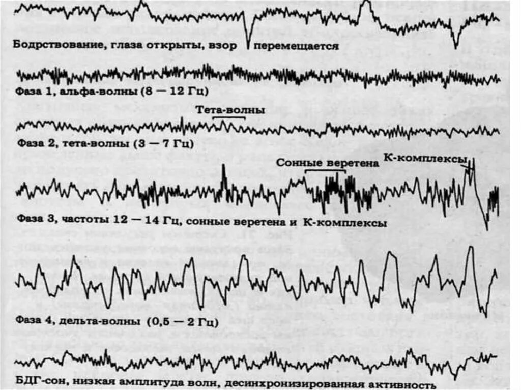 Ритмы мозга Альфа бета тета Дельта ритмы. Альфа тета Дельта волны. Волны мозга Альфа бета тета. Альфа волны головного мозга. Альфа волны тета волны