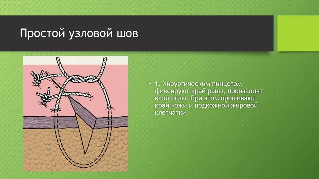 Х образный шов. Узловатый шов хирургия. Наложение хирургических швов Ветеринария.