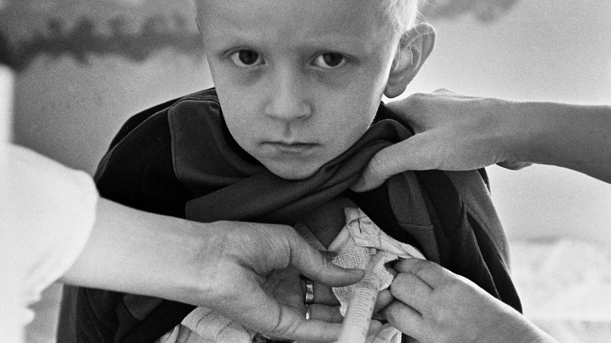 Облученные ликвидаторы чаэс. Чернобыль пострадавшие. Люди после аэс. Люди после аэс. Ликвидация чаэс.