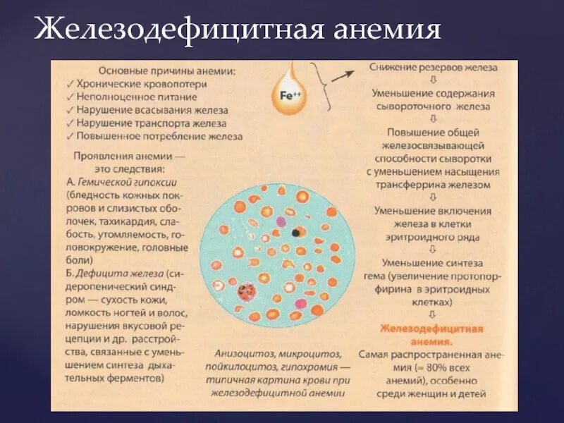 Анемия железодефицитная причины лечение. Анизоцитоз микроцитоз анемия. Жда микроцитоз пойкилоцитоз. Гемограмма крови при железодефицитной анемии. Анизоцитоз и пойкилоцитоз при анемии.