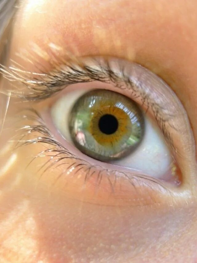 Почему желтым цветом глаз. Центральная гетерохромия зрачок. Центральная гетерохромия зеленый Карий. Центральная гетерохромия хамелеон. Гетерохромия Радужки глаз.