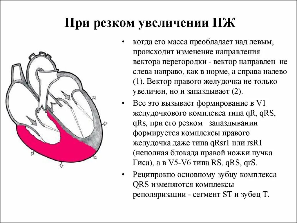 Гипертрофия отделов сердца. Увеличенные левые отделы сердца. Увлечение правого желудочка. Изменение желудочка сердца. Дилатация полостей предсердий