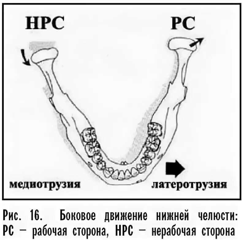 Латеральное движение. Латеротрузия нижней челюсти. латеральное движение нижней челюсти. боковые движения челюсти.