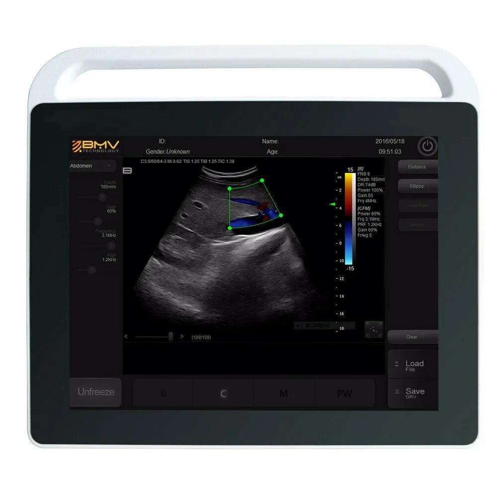 Экран аппарата узи. Handheld ultrasound system c3 hd3. экран узи аппарата. sonostar узи. монитор узи.