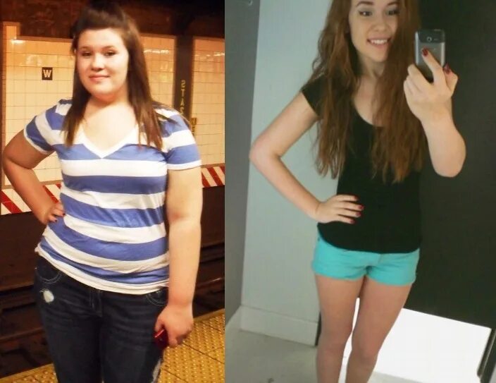 Полный подросток. Похудеть подростку. Полные девушки до и после.