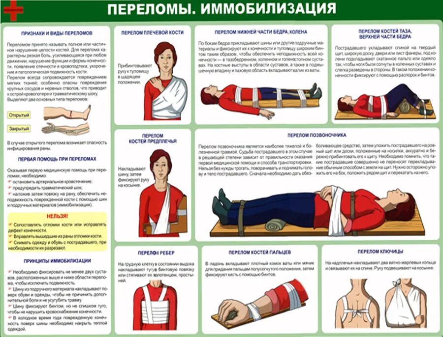 Переломы вывихи ушибы первая медицинская помощь. Алгоритм оказания первой помощи переломы конечностей. переломы оказание пмп при переломах. порядок оказания пмп пострадавшему с открытым переломом. буклет на тему иммобилизация при переломах конечностей.