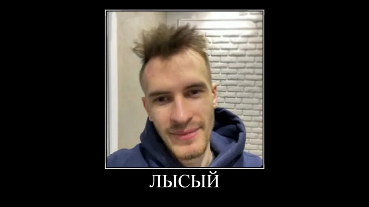 Ты зачем побрился. Ты зачем побрился. Прически с лысиной. Ты зачем побрился. До бритья и после прикол.