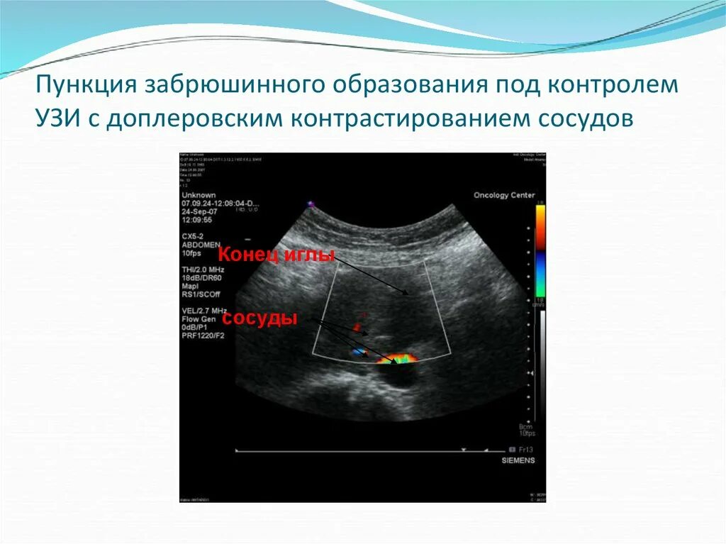 УЗИ органов брюшной полости и забрюшинного пространства. УЗИ брюшная полость и забрюшинное пространство. Забрюшинное пространство УЗИ. УЗИ почек и забрюшинного пространства. Брюшная полость что входит на узи