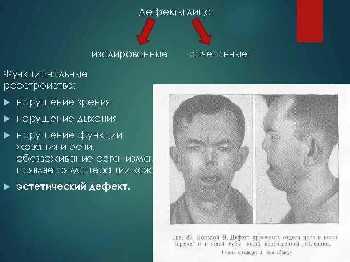 Дефектные лица. Портрет девушки с проблемной кожей. Дефектные лица. Девушка с проблемной кожей. Экман пол "эволюция эмоций".