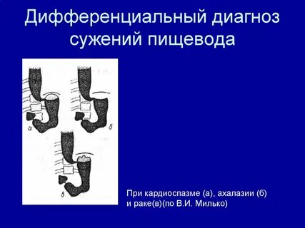 Диагностика пищевода