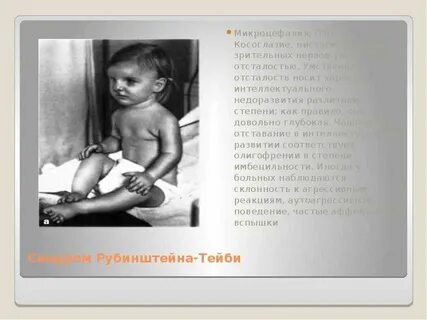 Микроцефалия умственная отсталость