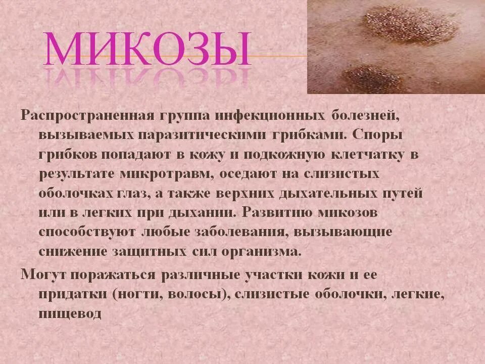 Грибковые заболевания кожи.