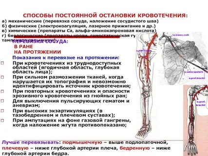 Перевязка артерий