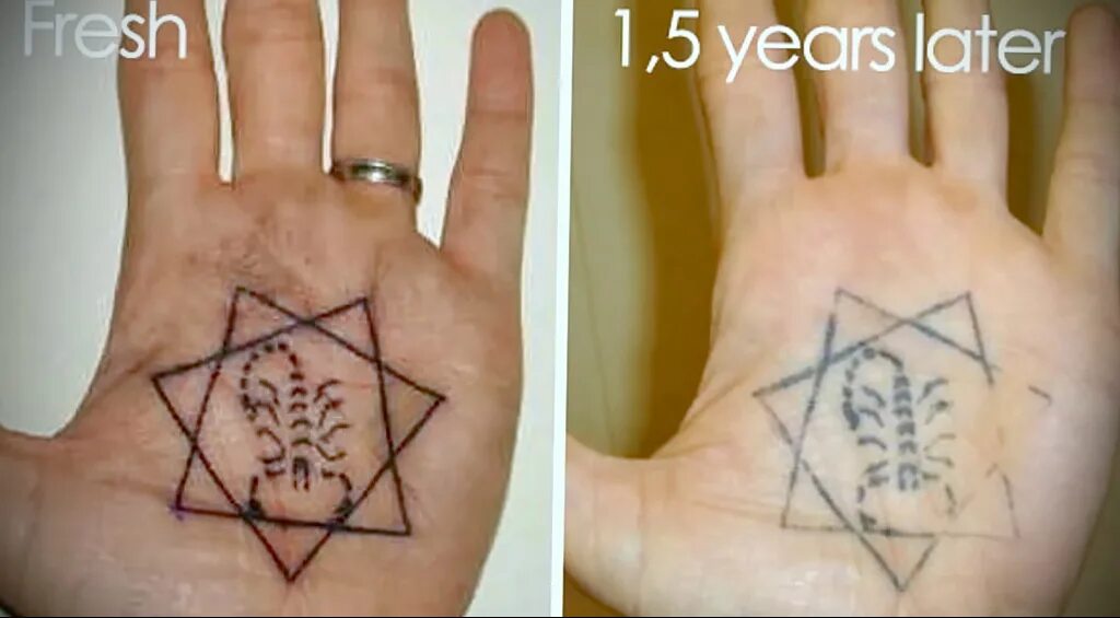 Татуировки спустя время. Татуировки через несколько лет. Татуировка через 10 лет. Черная Татуировка через несколько лет. Тату спустя год.