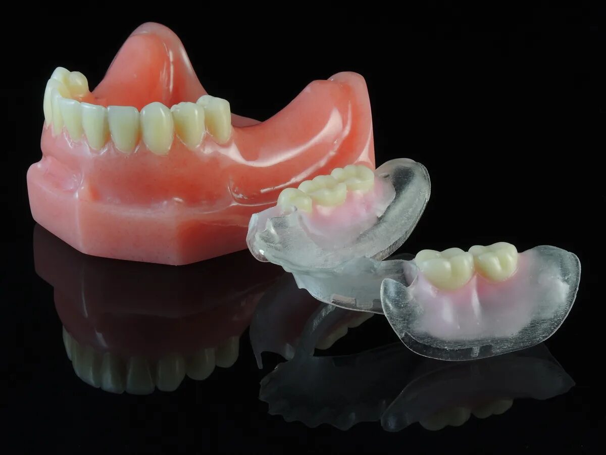 Зубы спб. Valplast нейлоновый протез. Велпласт зубные протезы. Съемный протез (3-5 зубов) термо Джет. Микропротез Квадротти.
