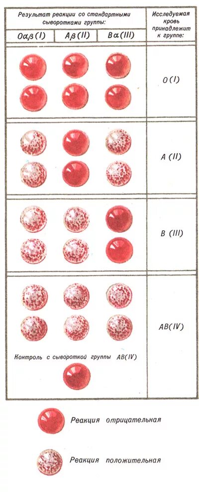 Определение группы крови. Ab0 группа крови. Определение группы крови ab0. Тарелка для определения группы крови. P ab 0