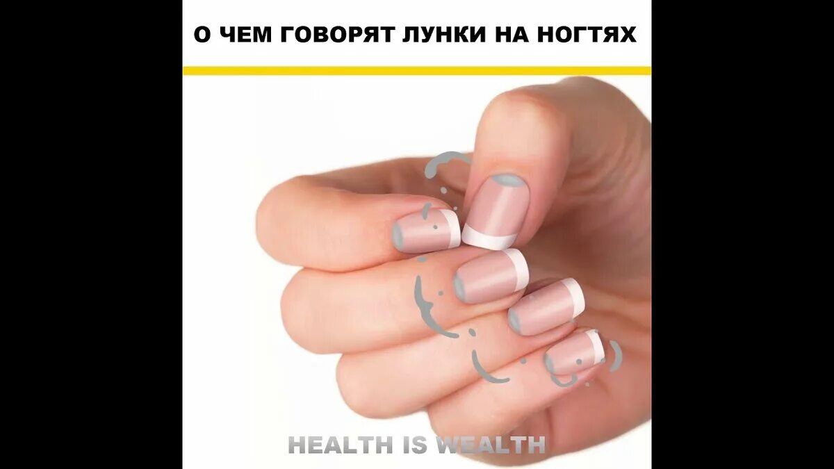 Почему исчезли лунки на ногтях. Лунулы на ногтях здорового человека. о чем говорят ногти. большие лунки на ногтях рук.