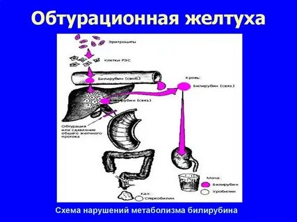 Механическая желтуха это