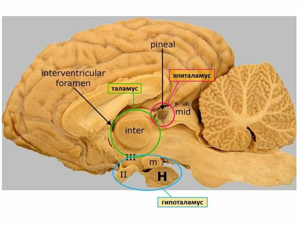 Большое полушарие мозолистое тело мост гипоталамус. Эпиталамус таламус эпиталамус. Таламус препарат анатомия. Таламус зрительный бугор анатомия. Промежуточный мозг таламус гипоталамус эпиталамус.