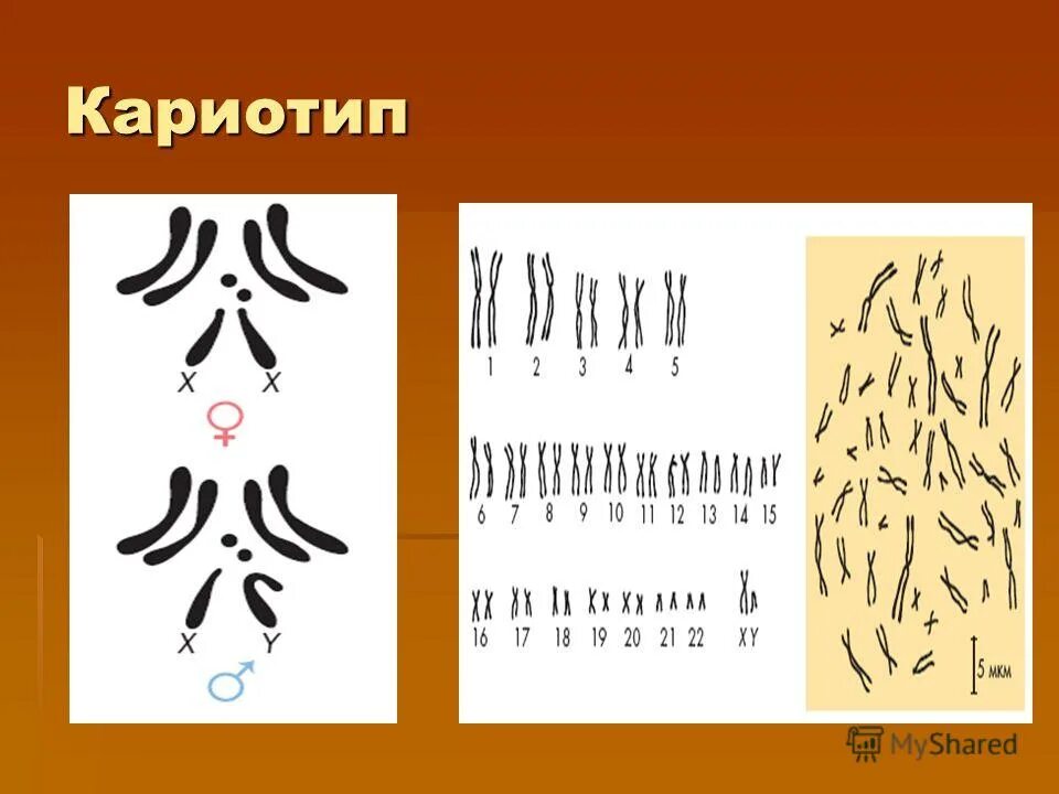 Кариотип человека определяют. Кариотип хромосомный набор. Нормальный кариотип. Мужской кариотип. Кариотип рисунок.