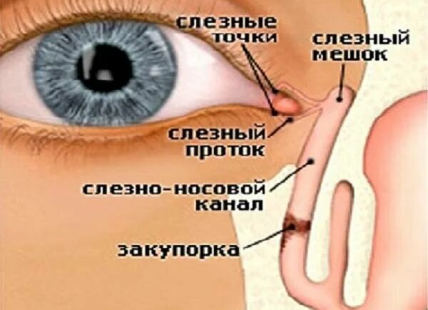 Массаж глаз слезного канала. Непроходимость носослезного канала. Закупорка слезного мешка. Закупорка слезного канала. Устье носослезного канала.