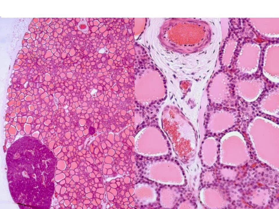 Щитовидная железа микропрепарат гистология. Щитовидная железа гистология. Срез щитовидной железы гистология. Щитовидная железа гистология препарат.