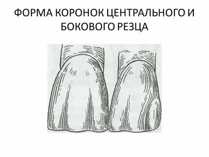 Форма коронок