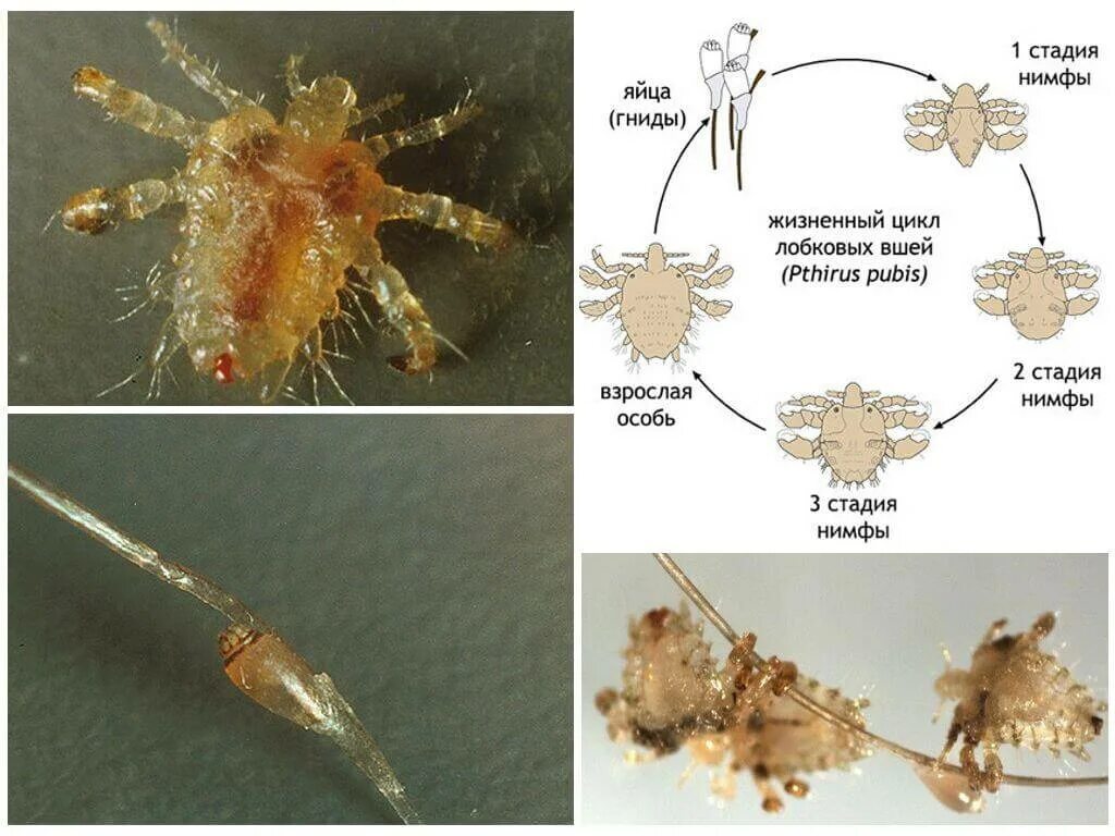 Педикулез карта. Жизненный цикл вшей Pediculus. Вша лобковая цикл развития. Фтириаз жизненный цикл. Вши головная платяная лобковая.