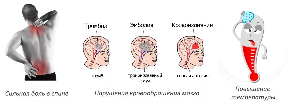 Улучшение кровообращения головного при шейном. Упражнения для кровообращения мозга. Упражнения для улучшения кровоснабжения головного мозга. Упражнения для кровообращения головы. Упражнения при нарушении кровообращения.