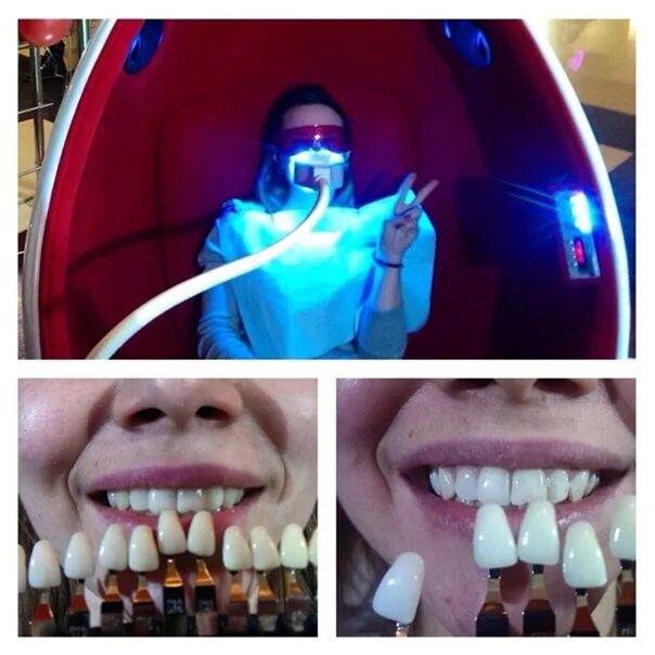 Отбеливание зубов Luma cool. Светодиодная лампа для зубов. Лазерное отбеливание зубов. Лампа для отбеливания зубов.