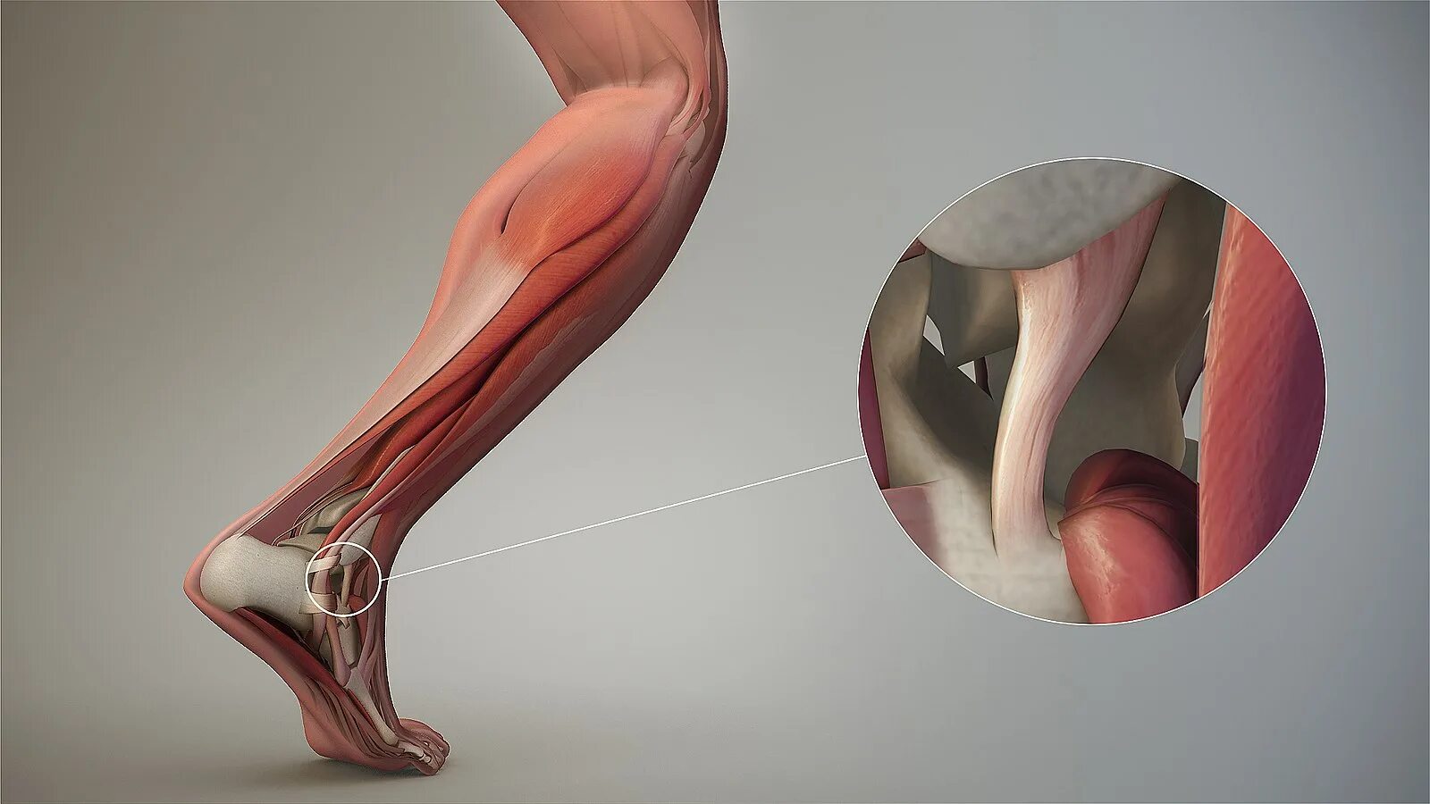 File:Ligament.jpg - Wikipedia
