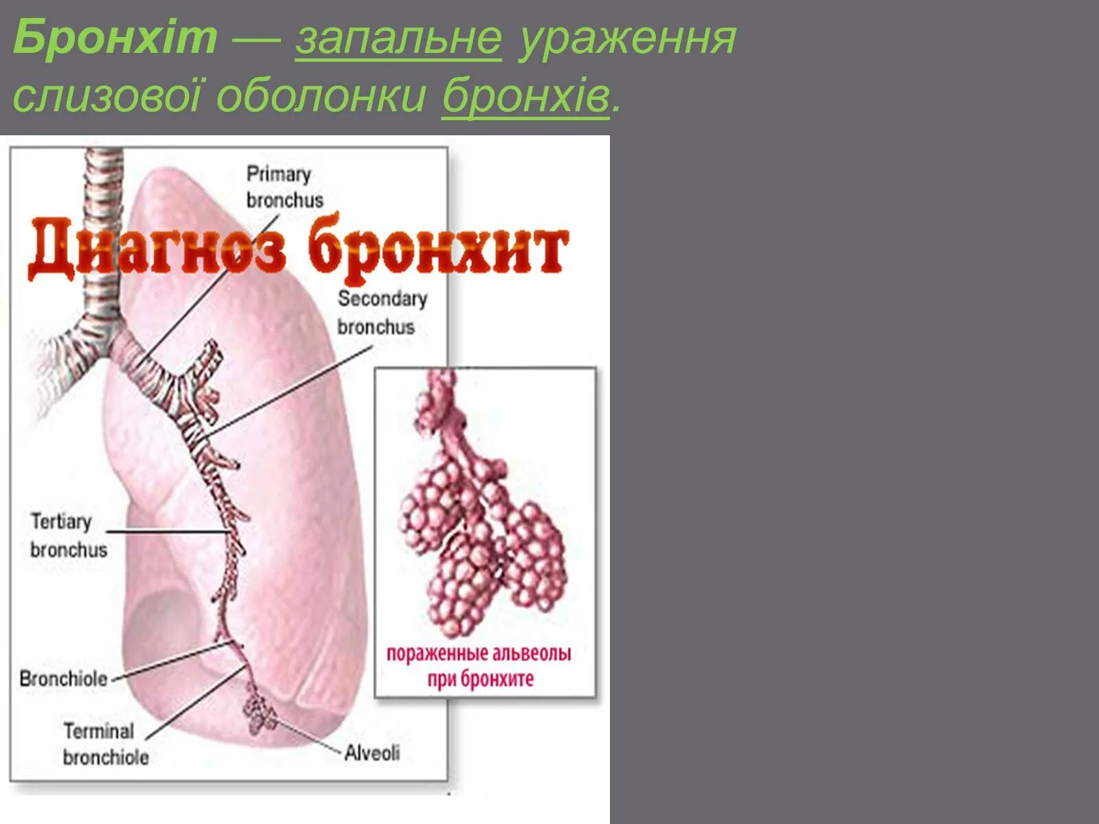 Квн это бронхит на. Бронхит строение. Как выглядят бронхи. Альвеолы легких строение.