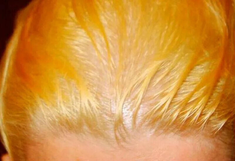 Волосы стали желтые